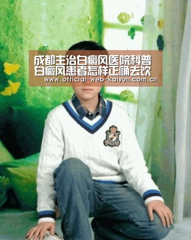 成都主治白癜风医院科普白癜风患者怎样正确去饮食“开云体育”(图1) 开云体育