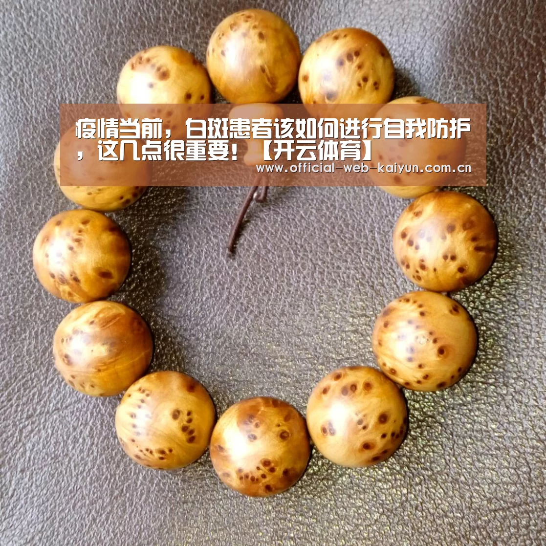 疫情当前,白斑患者该如何进行自我防护,这几点很重要!【开云体育】(图2) 开云体育